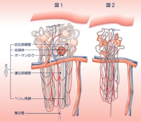 慢性腎不全とは